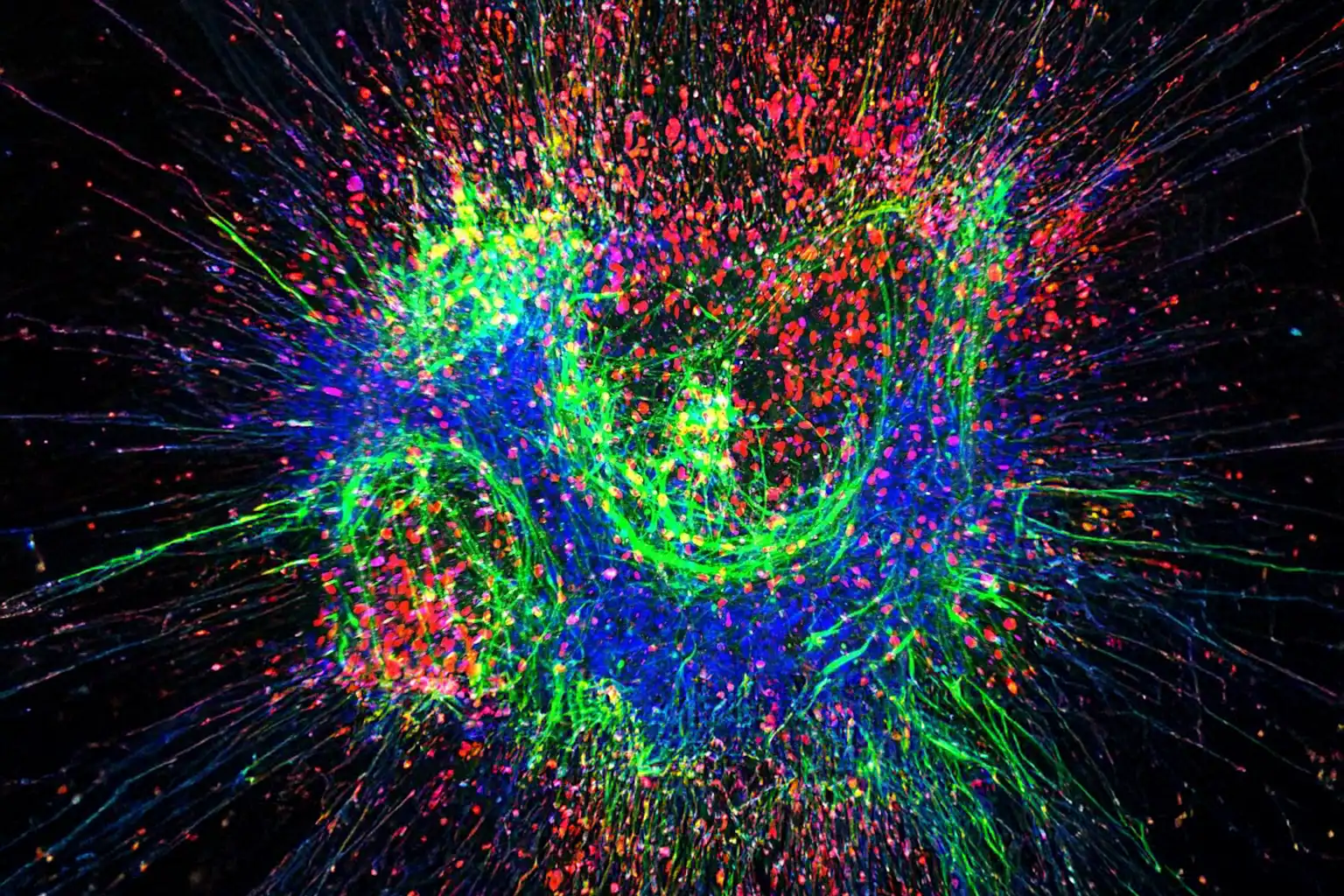 Nowy miniaturowy model ALS na chipie pozwala lepiej zrozumieć początki choroby ALS